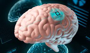 World’s First Brain Implant for Epileptic Seizures