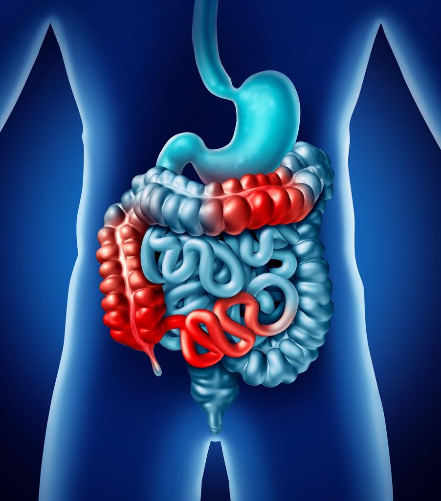 Antibiotics Lead to Inflammatory Bowel Diseases