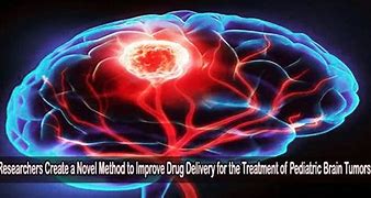 Unique Drug Delivery Method to Improve Treatment of Brain Tuberculosis