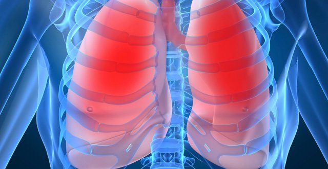 Idiopathic Pulmonary Fibrosis (IPF)