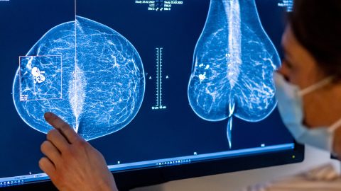 AI-Based Breast Cancer Detection tool