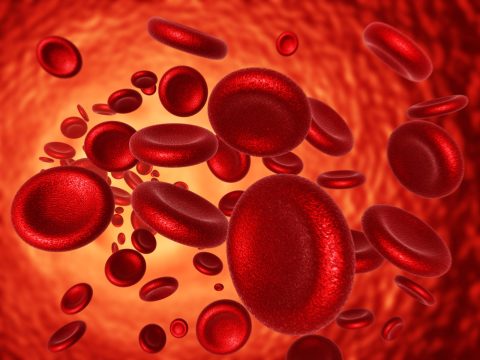 Anemia