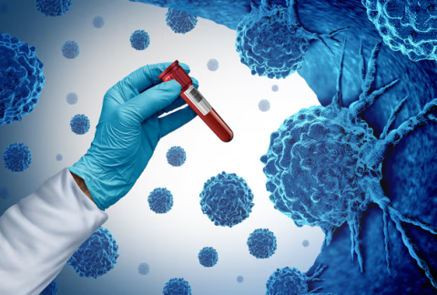 The WHO Global Status Report on Cancer 2026